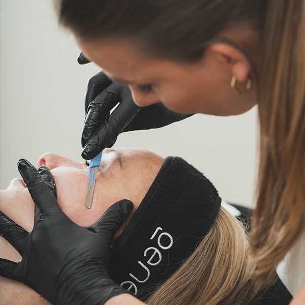 Dermaplaning Huidverbetering -Esprit De Vie